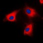 Anti-BCKDK Antibody